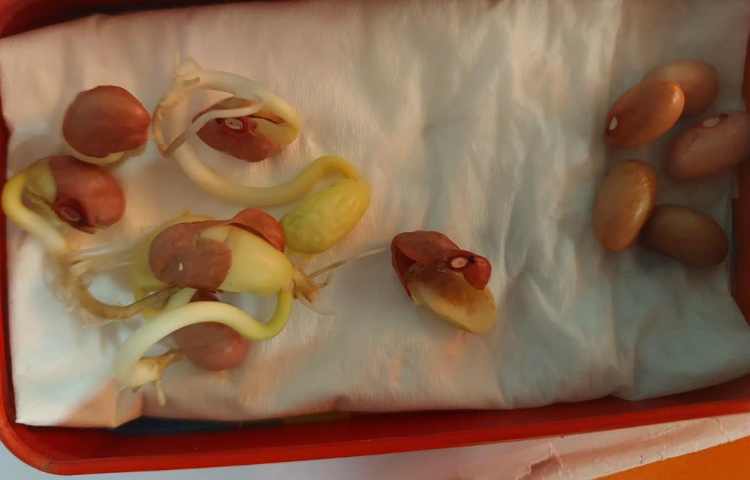 آزمایش تاثیر نور در رشد گیاه 4