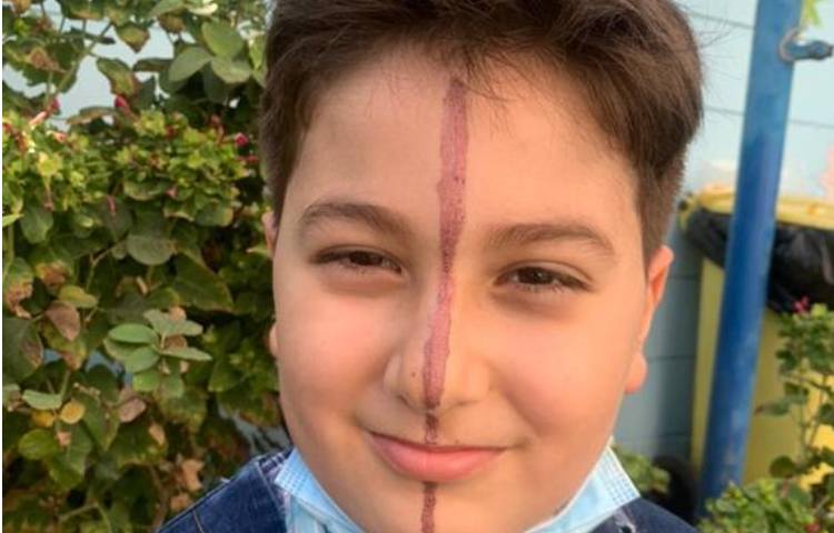 آموزش درس ریاضی ( خط تقارن) پایه سوم دبستان 1