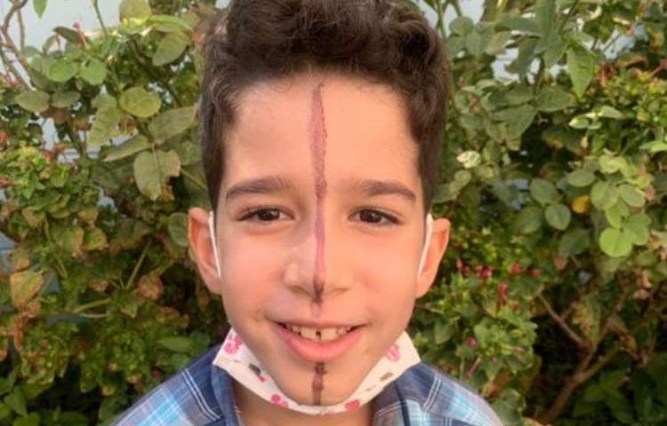 آموزش درس ریاضی ( خط تقارن) پایه سوم دبستان