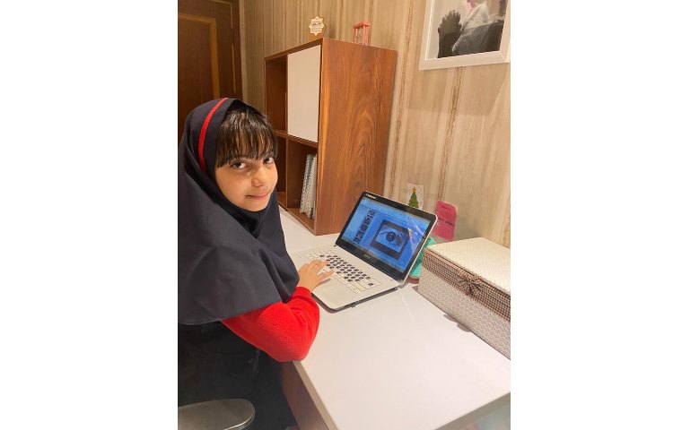 ارایه مطالب درمورد چشم درس علوم (رونیکاتوتونچی ) 1