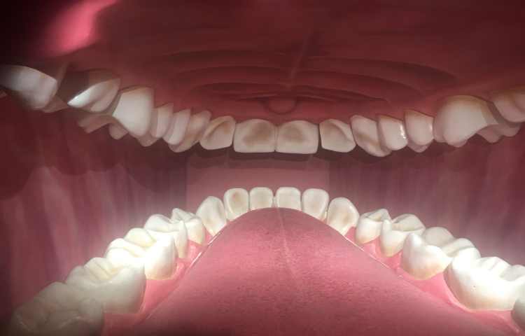 اردوی هیومن پارک 1