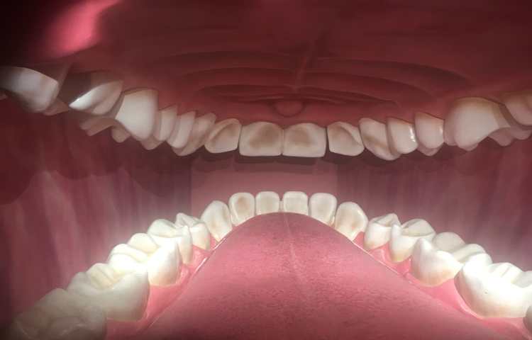 اردوی هیومن پارک 3