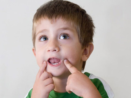 لکنت زبان رشدی یا تکاملی