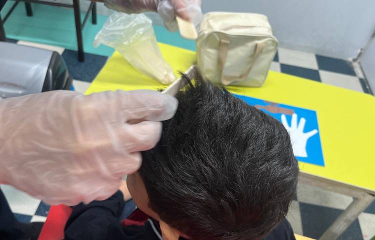 بررسی دوره‌ای پدیکلوز (کنترل بهداشت موی سر) 1