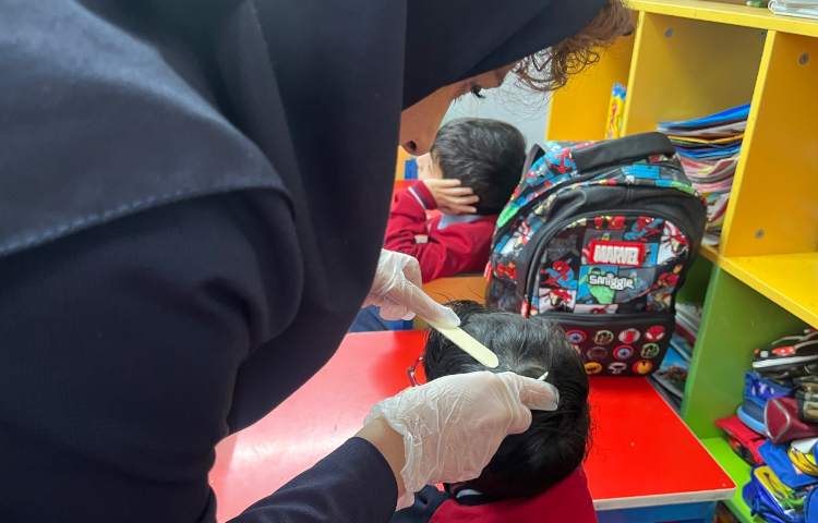 بررسی دوره‌ای پدیکلوز (کنترل بهداشت موی سر) 2