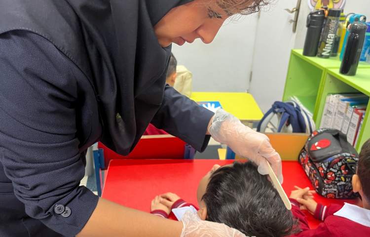 بررسی دوره‌ای پدیکلوز (کنترل بهداشت موی سر) 4