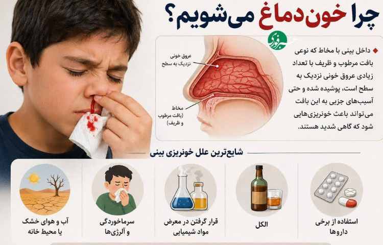 بهداشت چرا خون دماغ می‌شویم؟