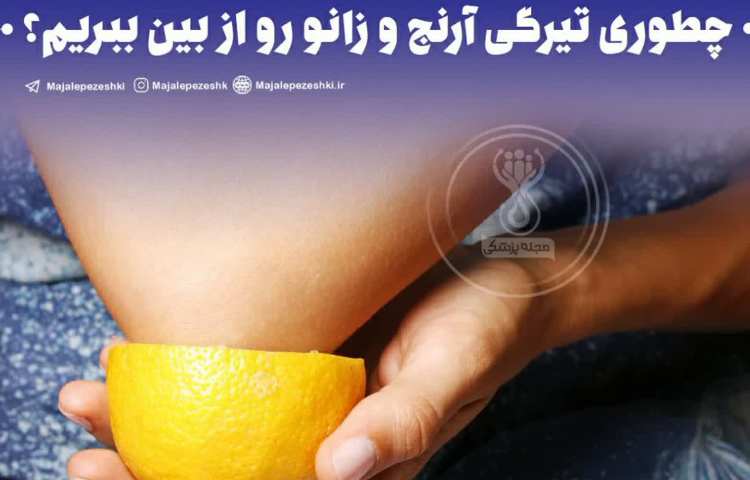بهداشت: چطوری تیرگی آرنج و زانو رو از بین ببریم !؟