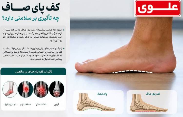 بهداشت کف پای صاف چه تاثیری بر سلامت دارد؟ 1
