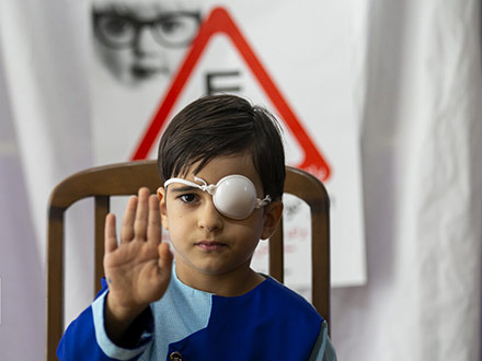 تنبلی چشم در کودکان