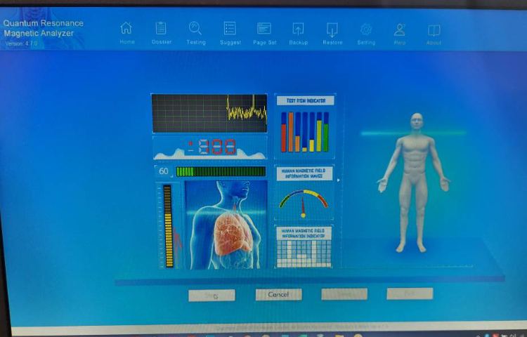 طرح پایش سلامت در دبستان های علوی 14