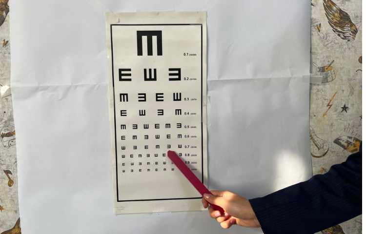 غربالگری تنبلی چشم 5