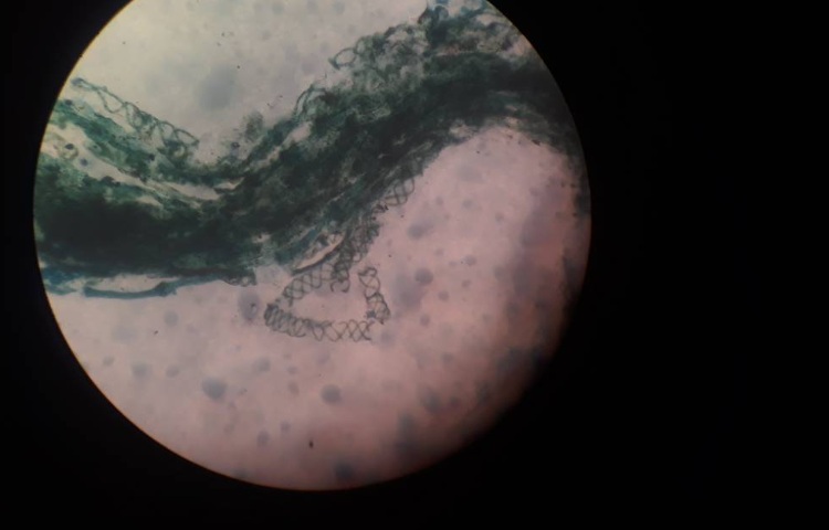 :فعالیت علوم، کلاس گیلاس