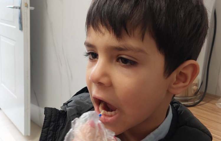 فلوراید تراپی با حضور کارشناسان مرکز بهداشت 6