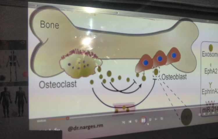 پوکی استخوان / اعصاب سنج (هفته ملی علوم) 7