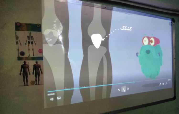 پوکی استخوان / اعصاب سنج (هفته ملی علوم) 8