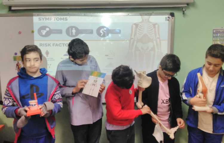 پوکی استخوان / اعصاب سنج (هفته ملی علوم)