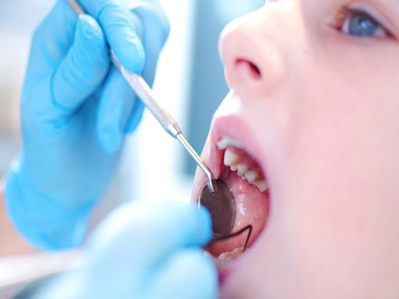 چرا چکاپ دندان کودکان را جدی بگیریم؟