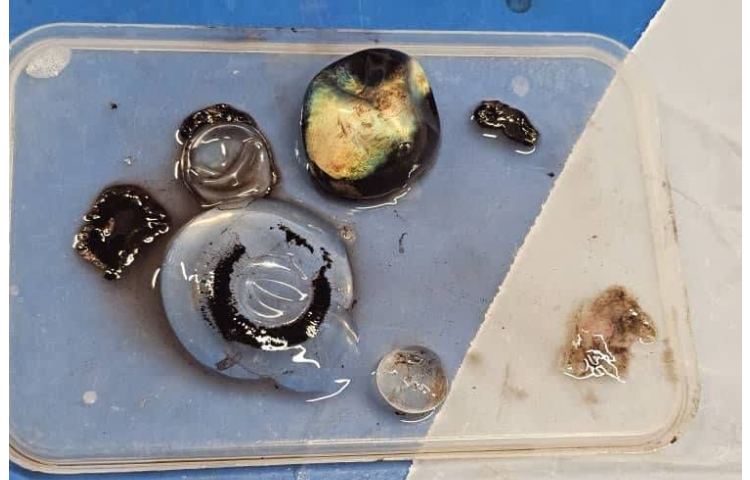 کلاس تشریح مغز و چشم 2